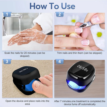 Eliminate Nail Fungus with White/Black Laser Treatment Device!