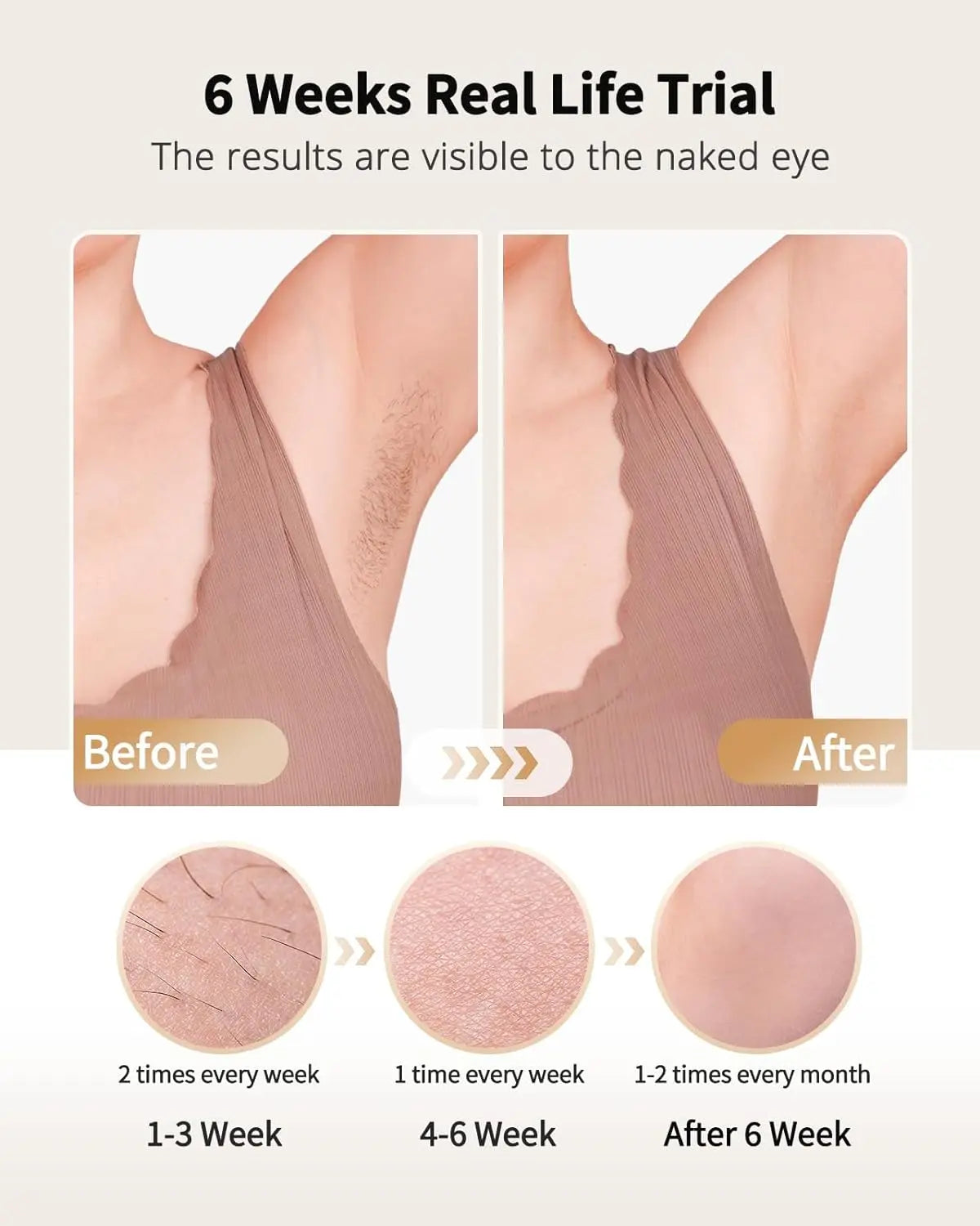 Achieve flawless, pain-free skin with the LYSMOK IPL Laser Hair Removal Device – advanced at-home epilator with ice cooling for women and men. Say goodbye to razors forever and hello to smooth results in weeks, right from your NovaZip beauty collection.