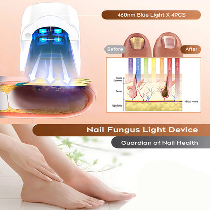 Eliminate Nail Fungus with White/Black Laser Treatment Device!