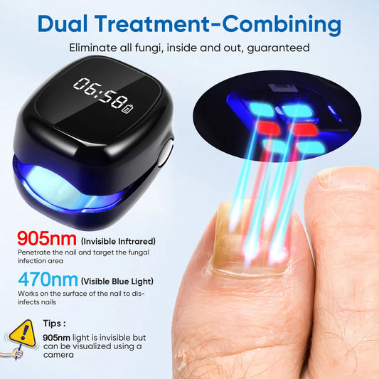 Eliminate Nail Fungus with White/Black Laser Treatment Device!