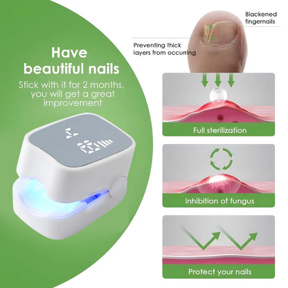 Eliminate Nail Fungus with White/Black Laser Treatment Device!