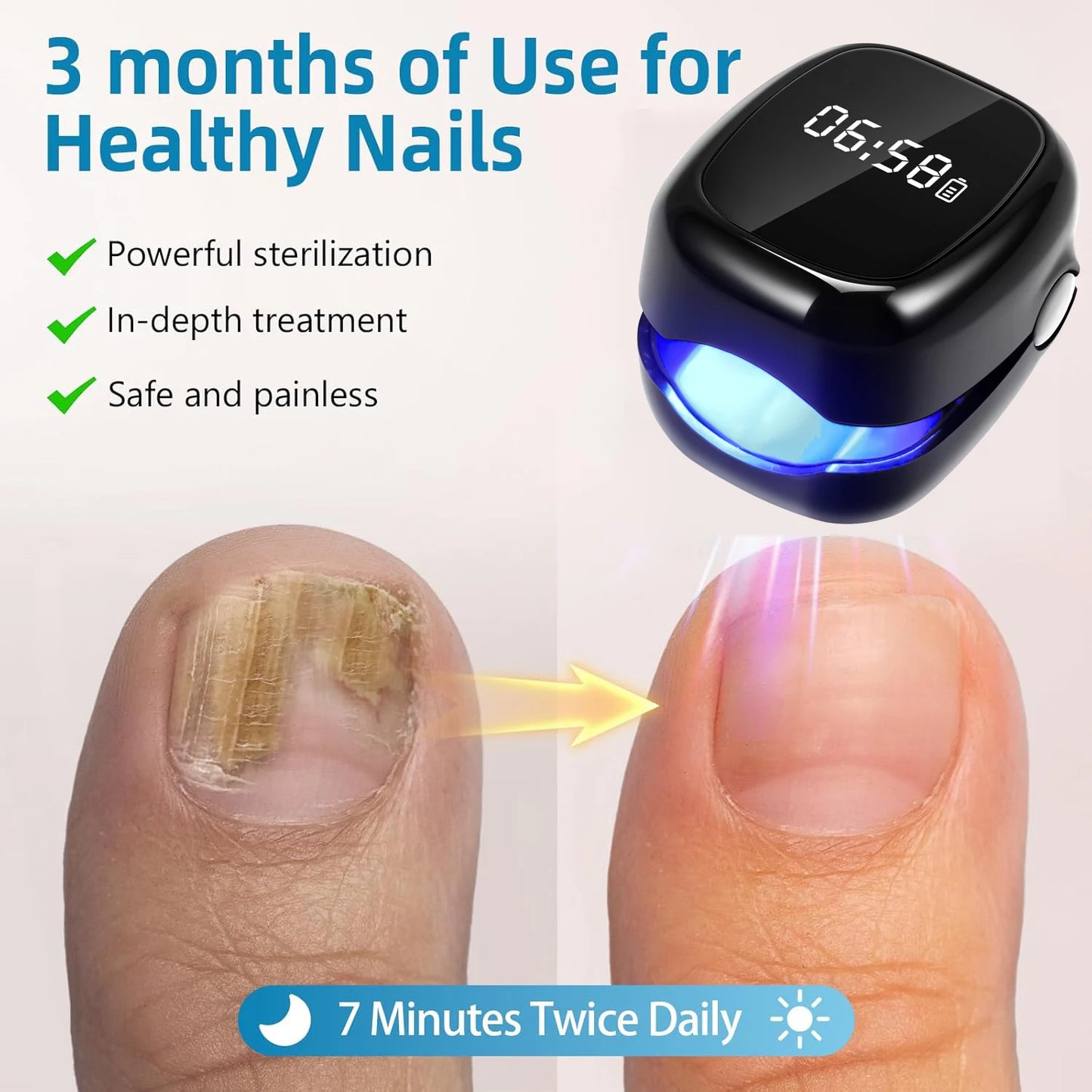 Eliminate Nail Fungus with White/Black Laser Treatment Device!
